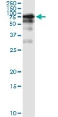 Immunoprecipitation: GGT1 Antibody (1F9) [H00002678-M01]