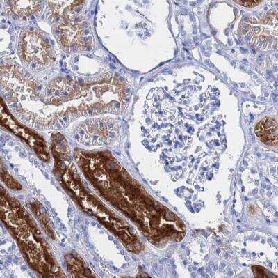 Immunohistochemistry-Paraffin: Gamma-glutamyltransferase 2 Antibody [NBP2-54724]