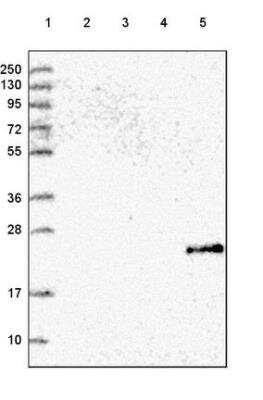 Western Blot: Gamma-glutamyltransferase 2 Antibody [NBP2-54724]