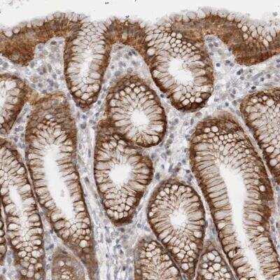 Immunohistochemistry-Paraffin: GGT6 Antibody [NBP1-81882]