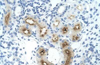 Immunohistochemistry-Paraffin: GGTLC1 Antibody [NBP1-56928]
