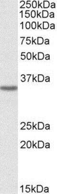 Western Blot: GHITM Antibody [NBP1-47217]