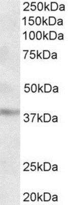 Western Blot: GHITM Antibody [NBP1-52001]