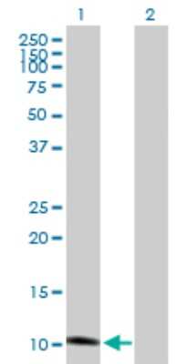 Western Blot: GHRH Antibody [H00002691-B01P]