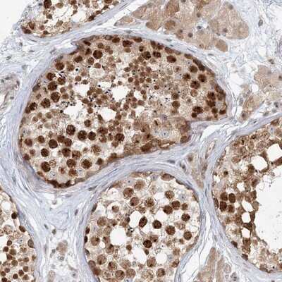 Immunohistochemistry-Paraffin: GIDRP88 Antibody [NBP1-91939]