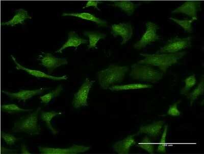 Immunocytochemistry/ Immunofluorescence: GIF Antibody (1D9) [H00002694-M03]
