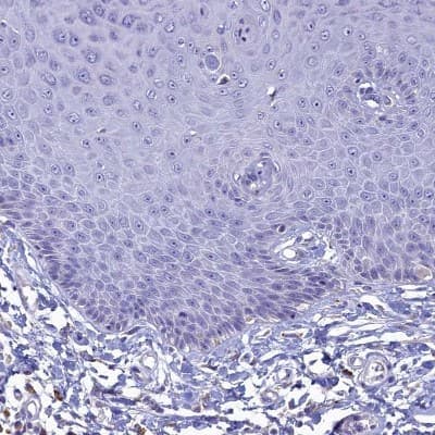 Immunohistochemistry-Paraffin: GIF Antibody [NBP1-81610]