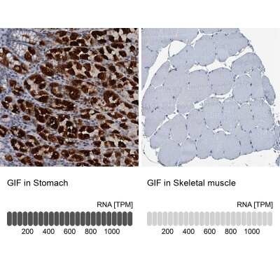 Immunohistochemistry-Paraffin: GIF Antibody [NBP1-81611]