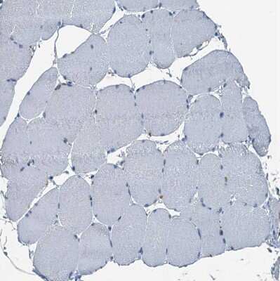 Immunohistochemistry-Paraffin: GIF Antibody [NBP1-81611]