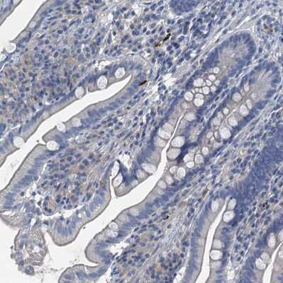 Immunohistochemistry-Paraffin: GIF Antibody [NBP1-81611]