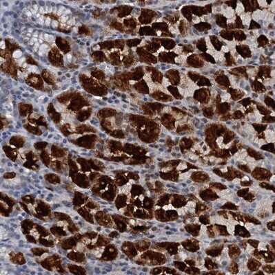 Immunohistochemistry-Paraffin: GIF Antibody [NBP1-81611]