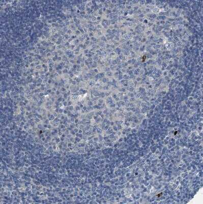 Immunohistochemistry-Paraffin: GIF Antibody [NBP1-81611]