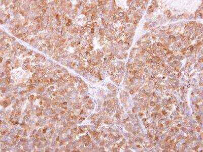 Immunohistochemistry-Paraffin: GILT/IFI30 Antibody [NBP1-32466]