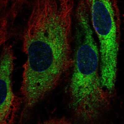 Immunocytochemistry/ Immunofluorescence: GIMAP1 Antibody [NBP2-55099]