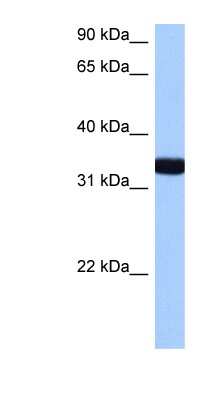 Western Blot: GIMAP1 Antibody [NBP1-59488]