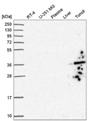 Western Blot: GIMAP1 Antibody [NBP2-55099]