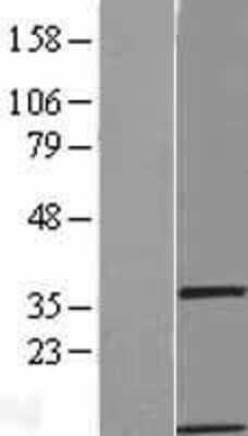 Western Blot: GIMAP1 Overexpression Lysate [NBL1-11071]