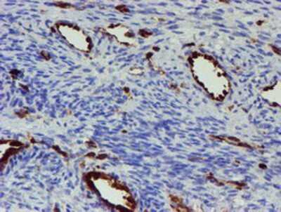 Immunohistochemistry-Paraffin: GIMAP4 Antibody (OTI1C6) [NBP2-03730]