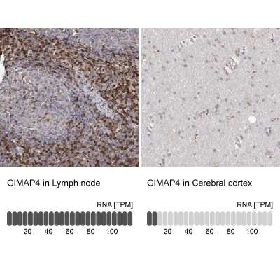 Immunohistochemistry-Paraffin: GIMAP4 Antibody [NBP1-83776]