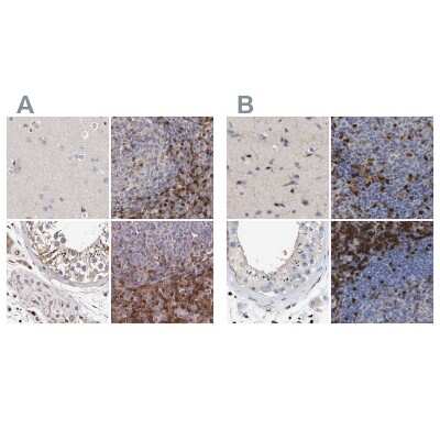 Immunohistochemistry-Paraffin: GIMAP4 Antibody [NBP1-83776]