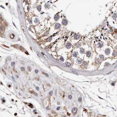 Immunohistochemistry-Paraffin: GIMAP4 Antibody [NBP1-83776]
