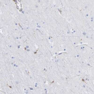 Immunohistochemistry-Paraffin: GIMAP4 Antibody [NBP1-83777]