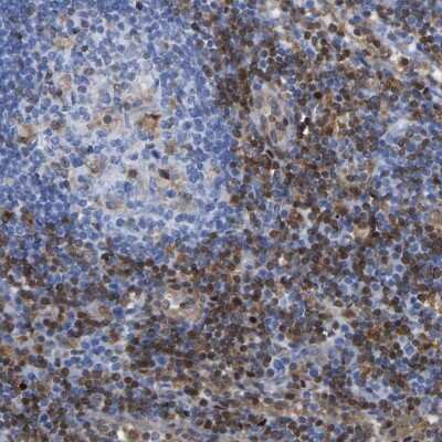 Immunohistochemistry-Paraffin: GIMAP4 Antibody [NBP1-83777]
