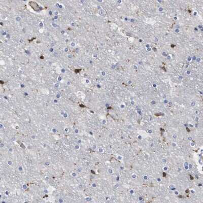 Immunohistochemistry-Paraffin: GIMAP4 Antibody [NBP1-83778]