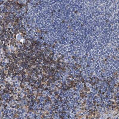 Immunohistochemistry-Paraffin: GIMAP4 Antibody [NBP1-83778]