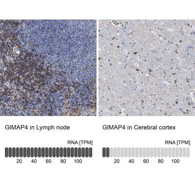 Immunohistochemistry-Paraffin: GIMAP4 Antibody [NBP1-83778]