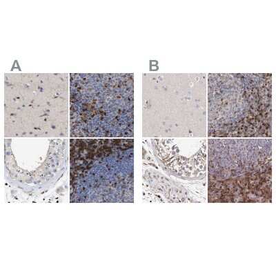 Immunohistochemistry-Paraffin: GIMAP4 Antibody [NBP1-83778]