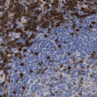 Immunohistochemistry-Paraffin: GIMAP4 Antibody [NBP1-83778]