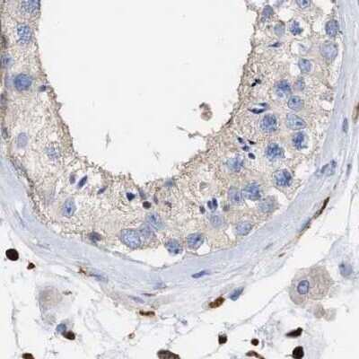Immunohistochemistry-Paraffin: GIMAP4 Antibody [NBP1-83778]