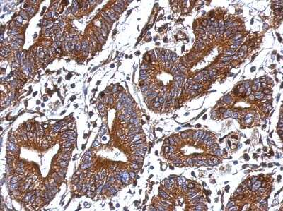 Immunohistochemistry-Paraffin: GIMAP4 Antibody [NBP2-16656]