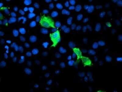 Immunocytochemistry/ Immunofluorescence: GIMAP4 Antibody (OTI1A11) - Azide and BSA Free [NBP2-71996]