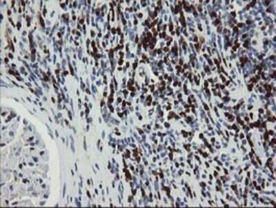 Immunohistochemistry: GIMAP4 Antibody (OTI1A11) - Azide and BSA Free [NBP2-71996]