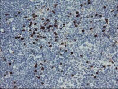 Immunohistochemistry: GIMAP4 Antibody (OTI1A11) - Azide and BSA Free [NBP2-71996]