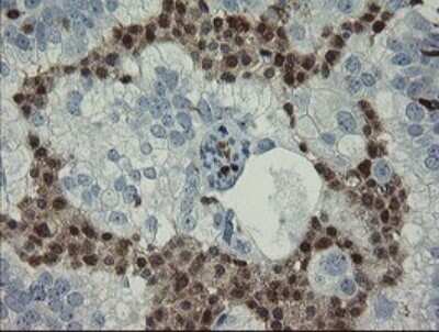 Immunohistochemistry: GIMAP4 Antibody (OTI1A11) [NBP2-45854]