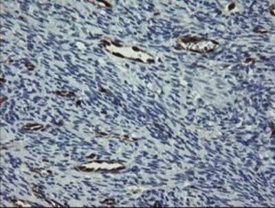 Immunohistochemistry: GIMAP4 Antibody (OTI1A11) [NBP2-45854]
