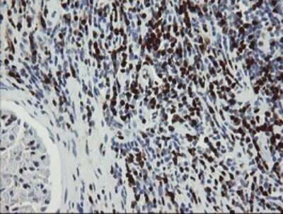 Immunohistochemistry: GIMAP4 Antibody (OTI1A11) [NBP2-45854]