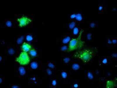Immunocytochemistry/ Immunofluorescence: GIMAP4 Antibody (OTI1C6) - Azide and BSA Free [NBP2-71997]