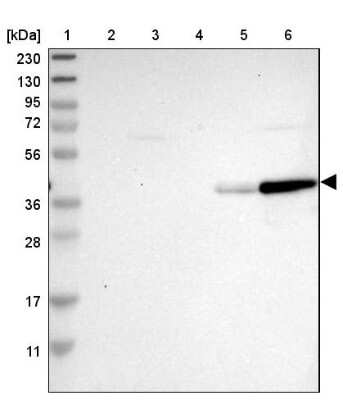 Western Blot: GIMAP4 Antibody [NBP1-83777]