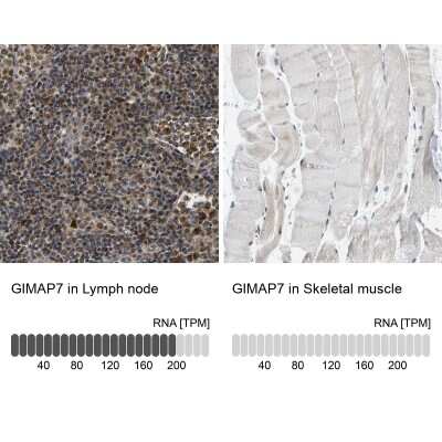 Immunohistochemistry-Paraffin: GIMAP7 Antibody [NBP1-81624]