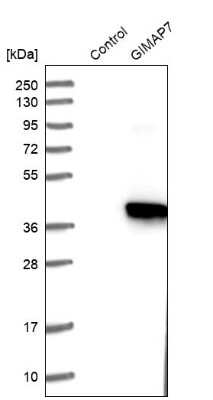Western Blot: GIMAP7 Antibody [NBP1-81625]