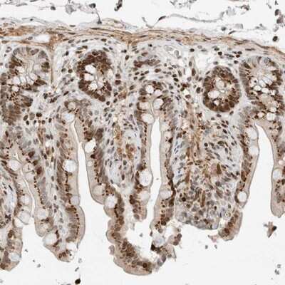 Immunohistochemistry-Paraffin: GINS4 Antibody [NBP1-82747]