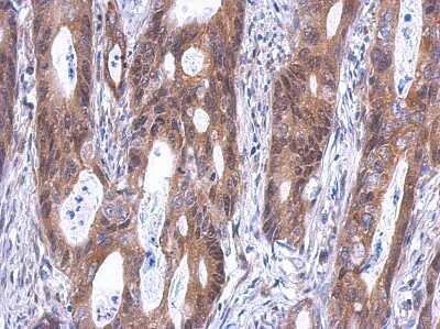 Immunohistochemistry-Paraffin: GINS4 Antibody [NBP2-16659]