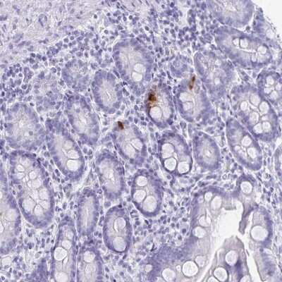 Immunohistochemistry-Paraffin: GIP Antibody [NBP1-86422]