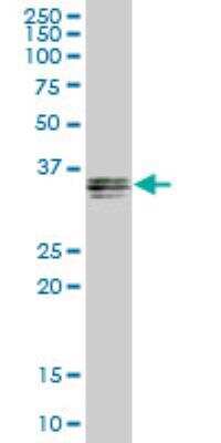 Western Blot: GIPC1 Antibody [H00010755-B01P]