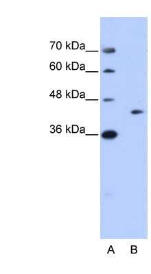 Western Blot: GIPC1 Antibody [NBP1-57426]