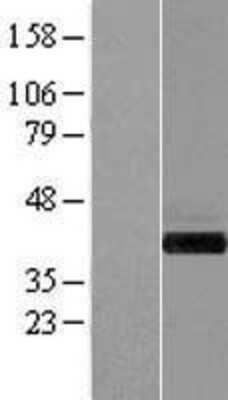 Western Blot: GIPC1 Overexpression Lysate [NBL1-11080]